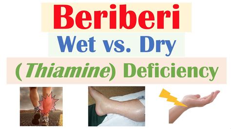 is dry beriberi dangerous